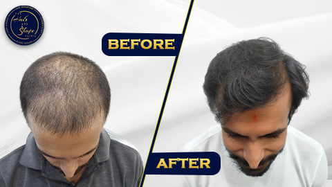 after-before